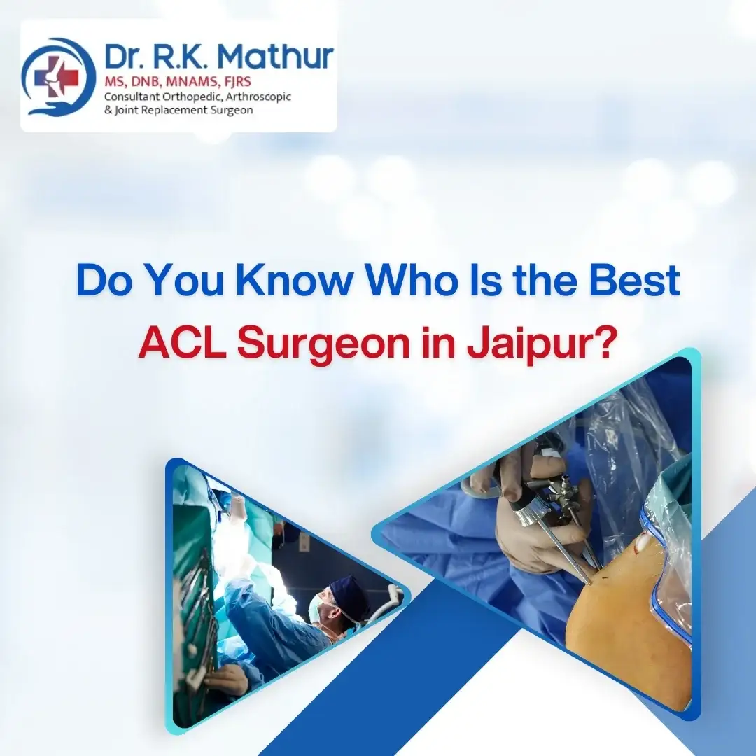 Do You Know Who Is the Best ACL Surgeon in Jaipur?